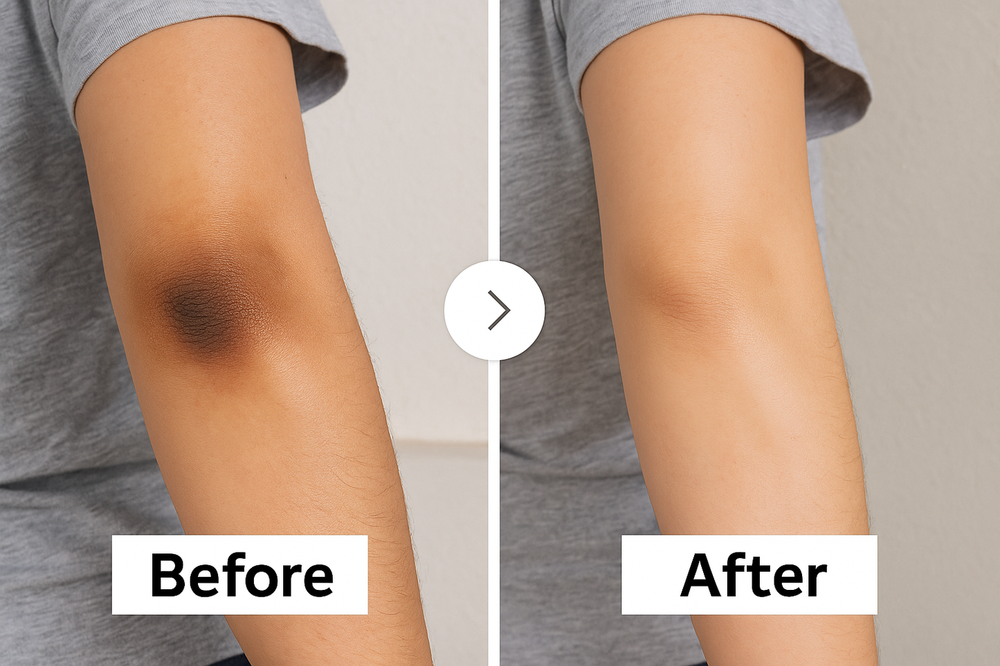 Glow C Serum —          40% Acerola