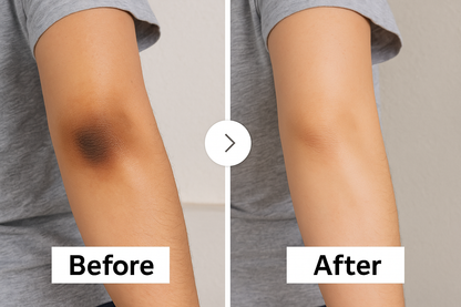 Glow C Serum —          40% Acerola