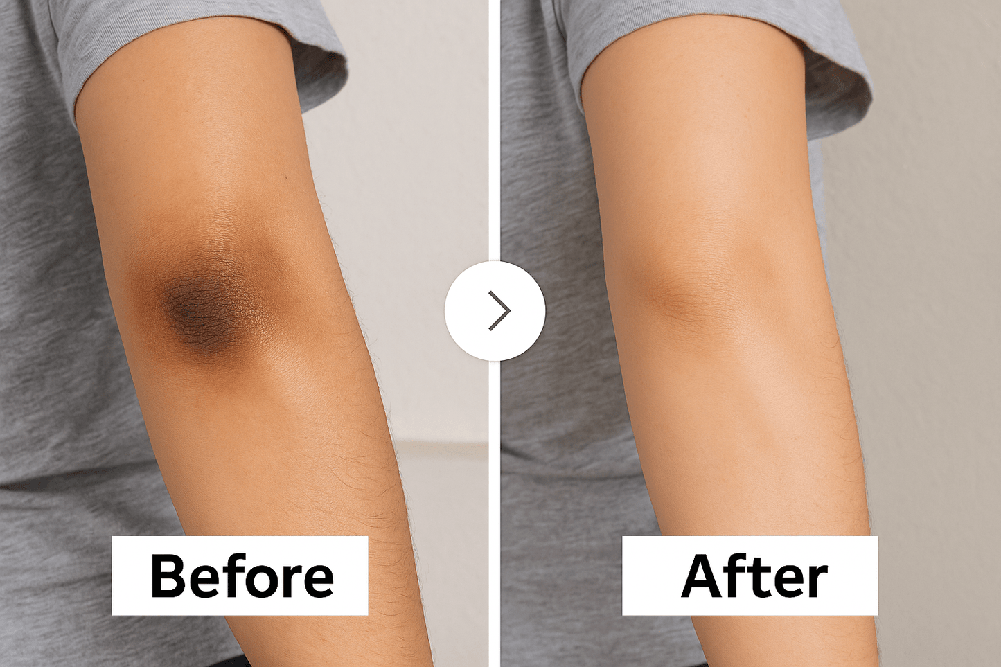 Glow C Serum — 40% Acerola - Sereniq